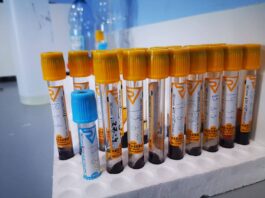 საქართველოში კორონავირუსით კიდევ 4 ადამიანი გარდაიცვალა