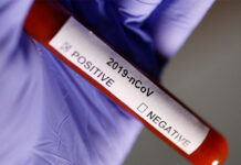 მსოფლიოში კორონავირუსით ინფიცირებულების რაოდენობამ 39 მილიონს გადააჭარბა