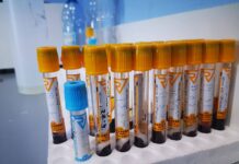 საქართველოში კორონავირუსით ინფიცირების 723 ახალი შემთხვევა გამოვლინდა