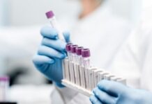 საქართველოში COVID-19-ის 160 ახალი შემთხვევა გამოვლინდა, გამოჯანმრთელდა 409