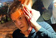 იგორ ნარმანიას თავს დაესხნენ